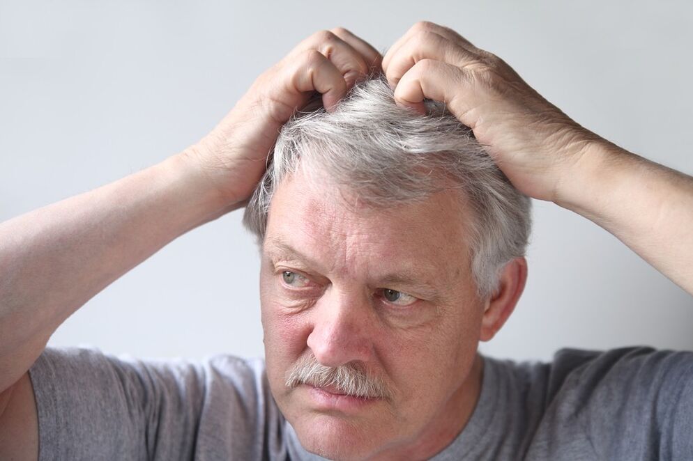 psoriazės simptomai ant galvos